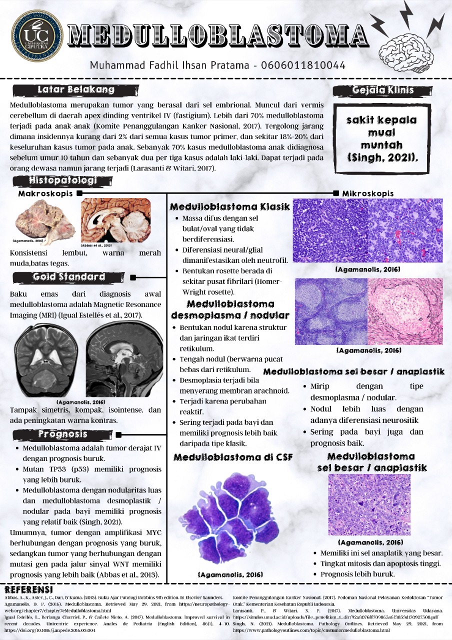 Medulloblastoma Medulloblastoma